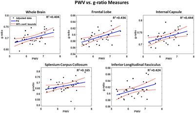 Investigation of the association between central arterial stiffness and aggregate g-ratio in cognitively unimpaired adults